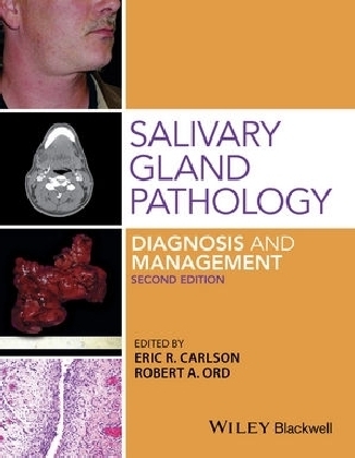 Salivary Gland Pathology Diagnosis and Management - Eric Carlson, Robert A. Ord