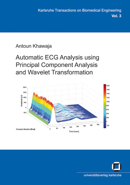 Automatic ECG analysis using principal component analysis and wavelet transformation - Antoun Khawaja