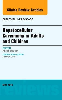 Hepatocellular Carcinoma in Adults and Children, An Issue of Clinics in Liver Disease - Adrian Reuben