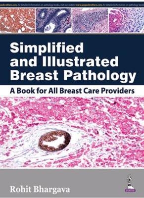 Simplified and Illustrated Breast Pathology - Rohit Bhargava