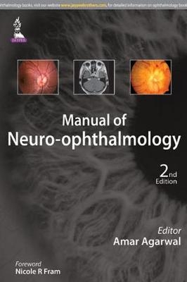 Manual of Neuro-ophthalmology - 