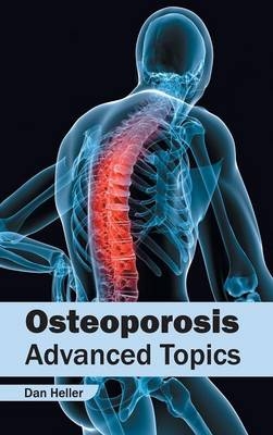 Osteoporosis: Advanced Topics - 