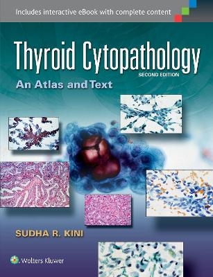 Thyroid Cytopathology - Sudha R. Kini