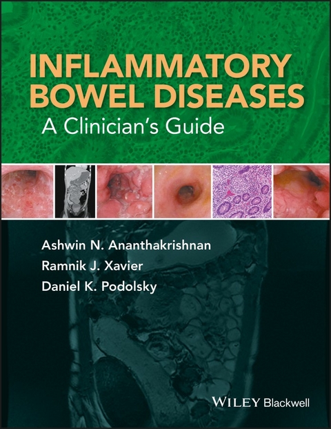 Inflammatory Bowel Diseases - Ashwin N. Ananthakrishnan, Ramnik J. Xavier, Daniel K. Podolsky