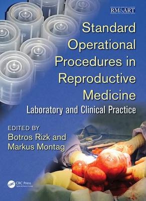 Standard Operational Procedures in Reproductive Medicine - 