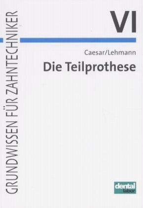 Die Teilprothese - Hans H Caesar, Klaus M Lehmann