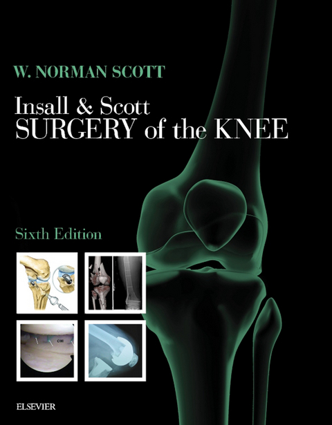 Insall & Scott Surgery of the Knee E-Book -  W. Norman Scott