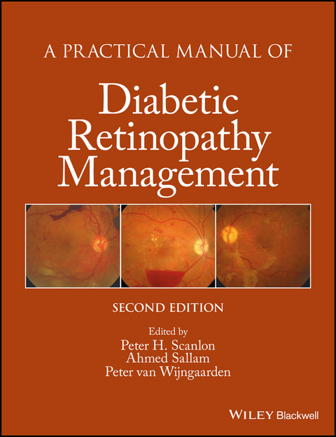 A Practical Manual of Diabetic Retinopathy Management - 