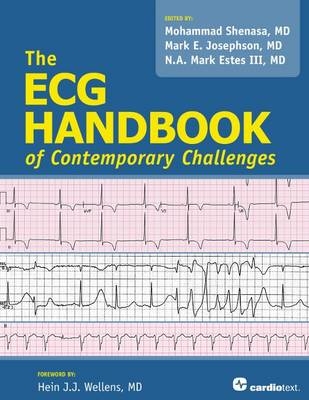 ECG Handbook of Contemporary Challenges - Mohammad Shenasa, Mark E. Josephson, N. A. Mark Estes