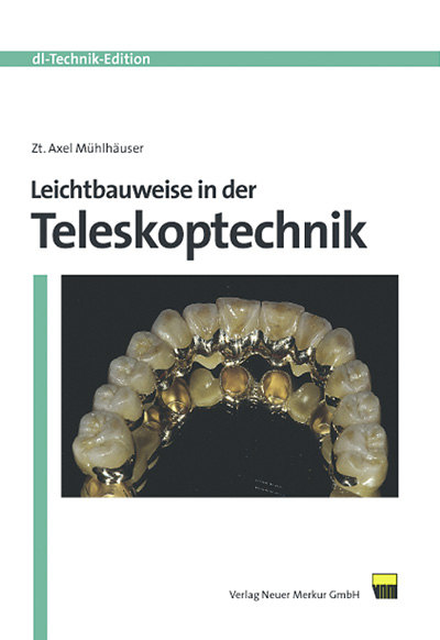 Leichtbauweise in der Teleskoptechnik - Axel Mühlhäuser