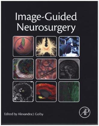 Image-Guided Neurosurgery - 