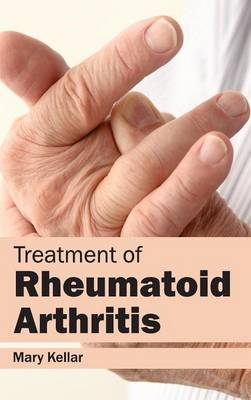 Treatment of Rheumatoid Arthritis - 