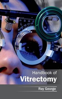 Handbook of Vitrectomy - 