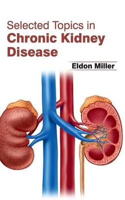 Selected Topics in Chronic Kidney Disease - 