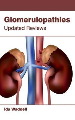 Glomerulopathies: Updated Reviews - 