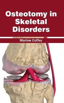 Osteotomy in Skeletal Disorders - 