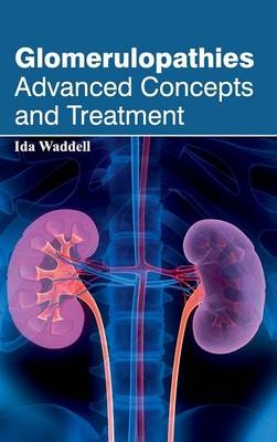 Glomerulopathies: Advanced Concepts and Treatment - 