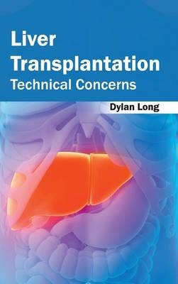 Liver Transplantation: Technical Concerns - 