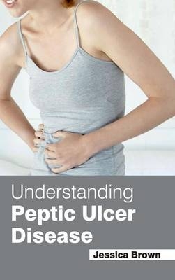 Understanding Peptic Ulcer Disease - 