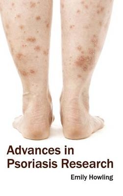 Advances in Psoriasis Research - 