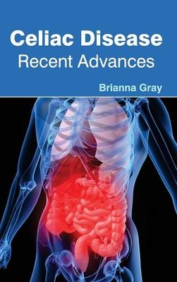 Celiac Disease: Recent Advances - 