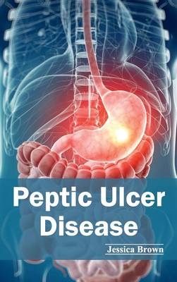 Peptic Ulcer Disease - 