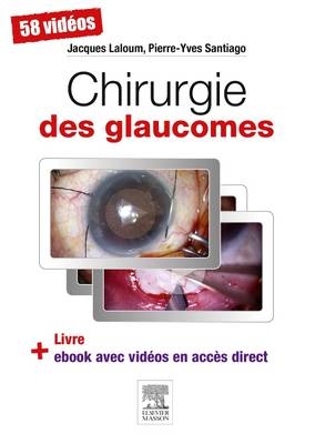 Chirurgie des glaucomes -  Jacques LALOUM,  Pierre-Yves Santiago