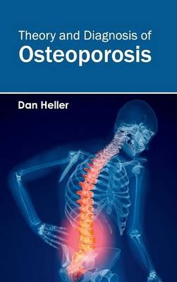 Theory and Diagnosis of Osteoporosis - 