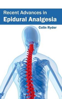 Recent Advances in Epidural Analgesia - 