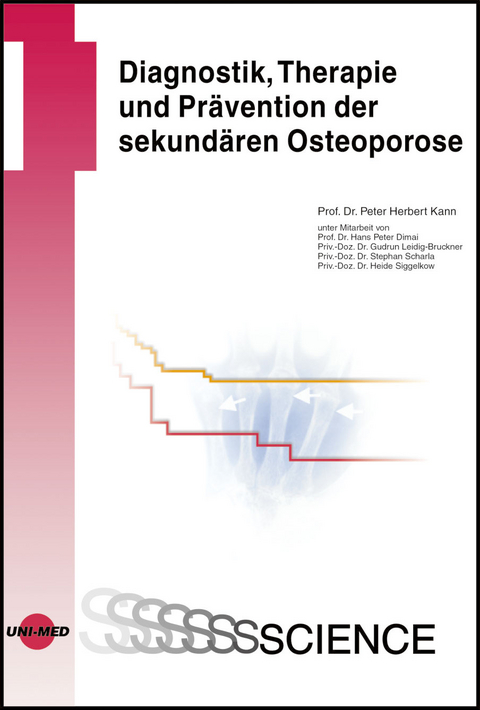 Diagnostik, Therapie und Prävention der sekundären Osteoporose - Peter H Kann