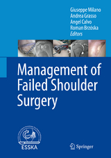 Management of Failed Shoulder Surgery - 