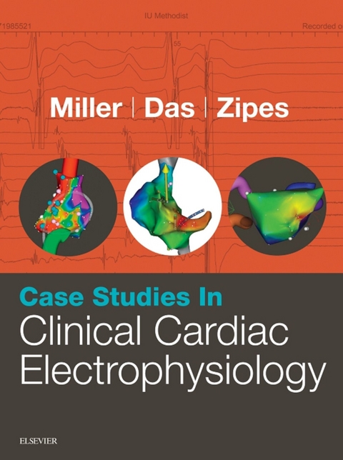 Case Studies in Clinical Cardiac Electrophysiology E-Book -  Mithilesh K. Das,  John M. Miller,  Douglas P. Zipes