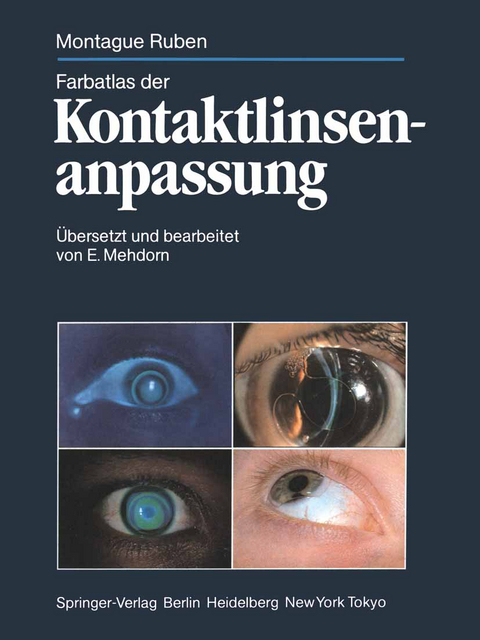 Farbatlas der Kontaktlinsenanpassung - Montague Ruben