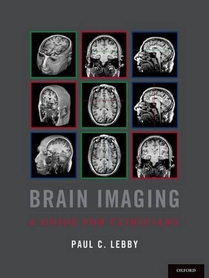 Brain Imaging - Paul C. Lebby