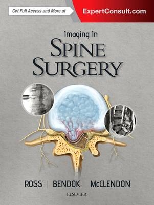 Imaging in Spine Surgery E-Book -  Bernard R. Bendock,  Jamal McClendon Jr.,  Jeffrey S. Ross