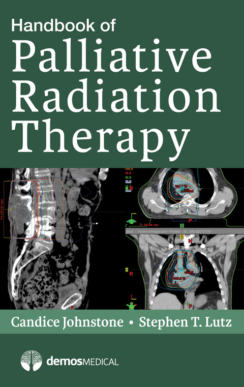 Handbook of Palliative Radiation Therapy - MS Stephen T. Lutz MD