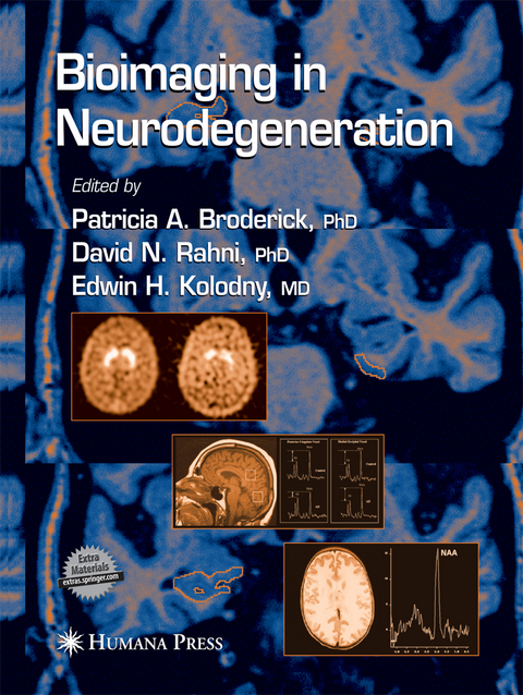 Bioimaging in Neurodegeneration - 