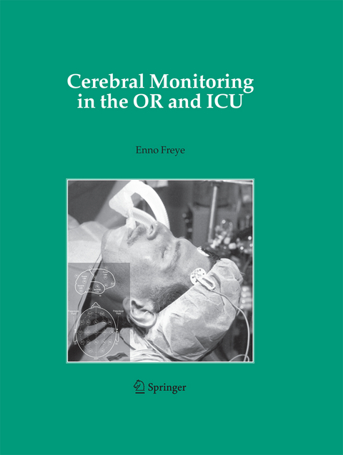 Cerebral Monitoring in the OR and ICU - 