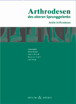 Arthrodesen des oberen Sprunggelenks - 