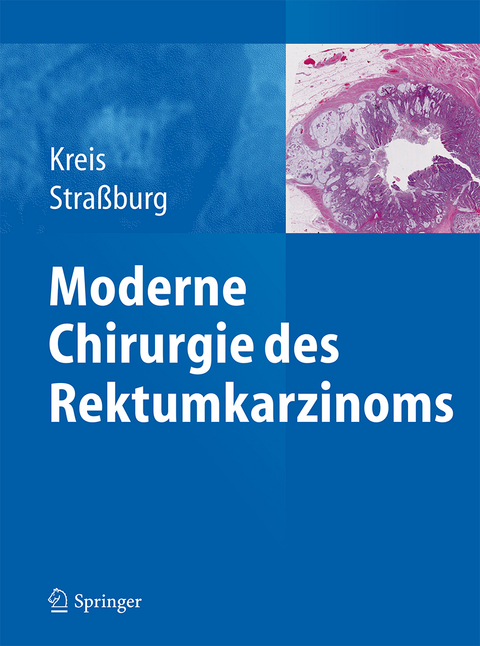 Moderne Chirurgie des Rektumkarzinoms - 