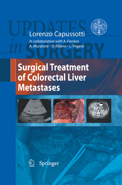 Surgical Treatment of Colorectal Liver Metastases - 