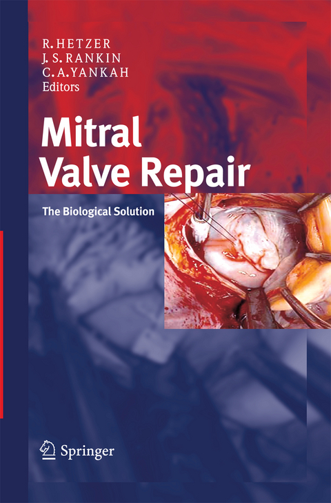 Mitral Valve Repair - 