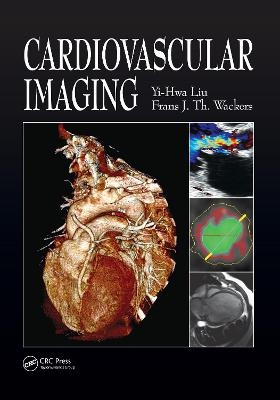 Cardiovascular Imaging - Yi-Hwa Liu, Frans Wackers