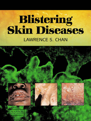 Blistering Skin Diseases - Lawrence Chan