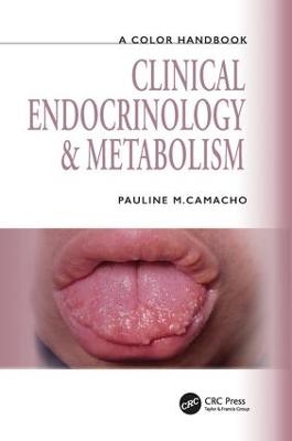 Clinical Endocrinology and Metabolism - Pauline Camacho