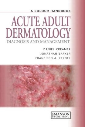 Acute Adult Dermatology - Daniel Creamer, Jonathan Barker, Francisco A. Kerdel