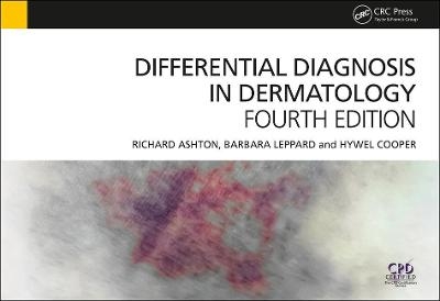 Differential Diagnosis in Dermatology - Richard Ashton, Barbara Leppard