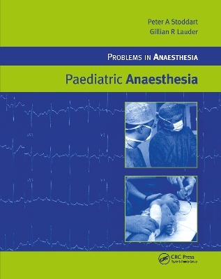 Paediatric Anaesthesia - 