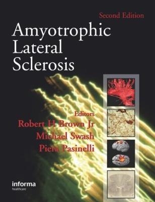 Amyotrophic Lateral Sclerosis, Second Edition - 