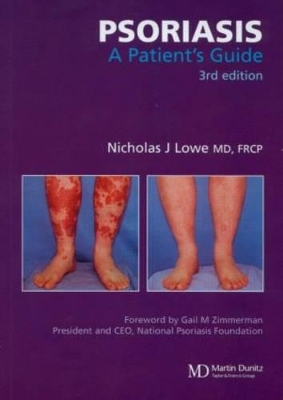 Psoriasis - Nicholas J. Lowe